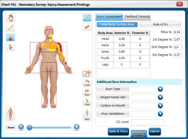 Ems Charting Software